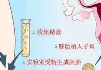 马来西亚试管婴儿费用具体有哪些收费地方／