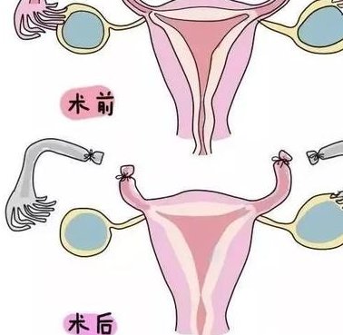 今年上海做试管婴儿要多少钱？#160;？